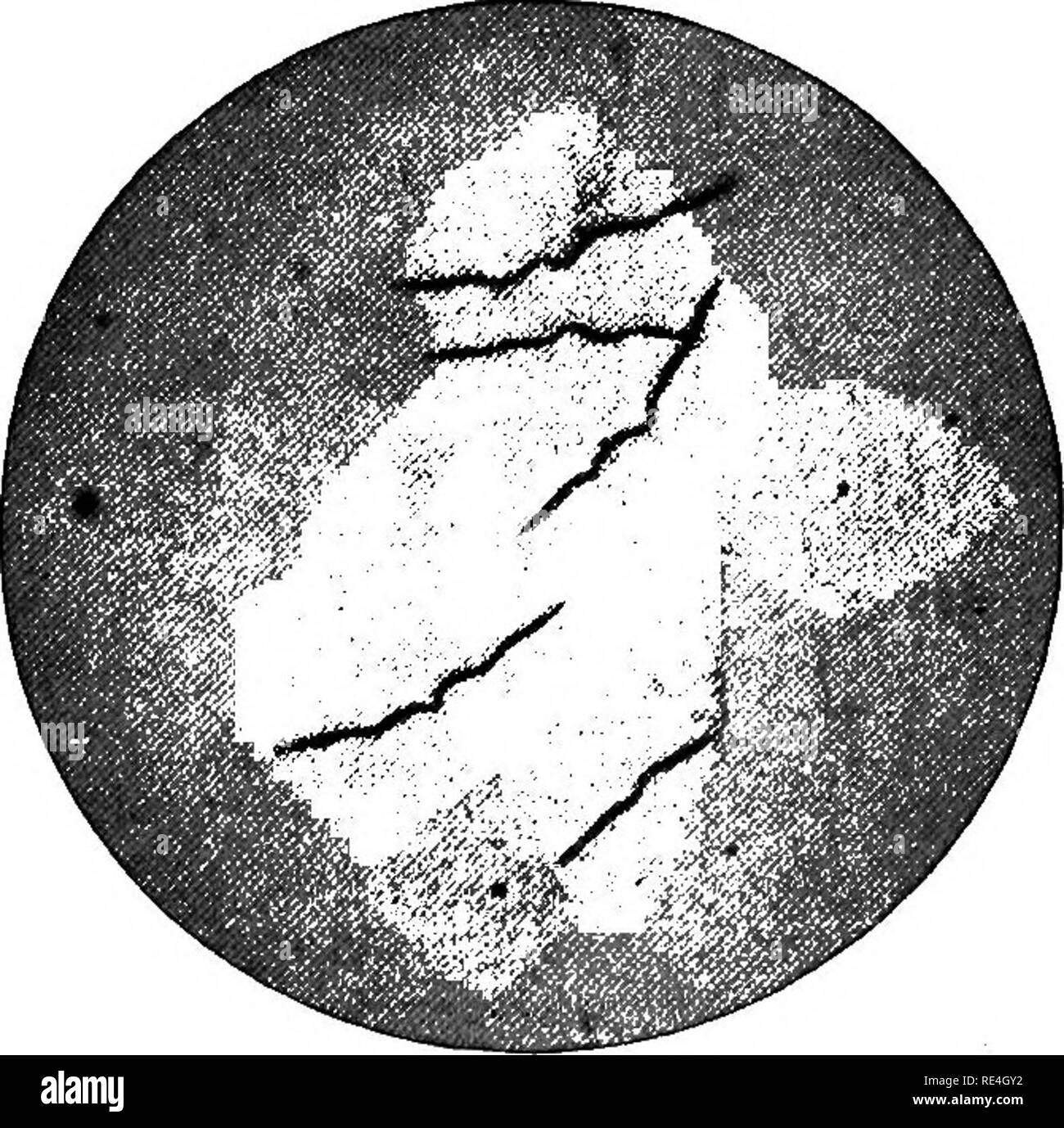 . Un libro di testo su batteri patogeni e protozoi per gli studenti di medicina e medici. Batteriologia; batteri patogeni; protozoi. 436 Vincent's Angina glucosio-bouillon.-nessuna crescita quando più di quanto io per cento di glucosio è presente. Il mezzo è offuscato con alcuni dei sedimenti. Da tutte le culture un alquanto offensiva odore è dato fuori.. Fig. 164.-Bacillus fusiformis. Pura coltura cresciuta quattro giorni in brodo di ascite (Rut Tunnicliff in "ufficiale di Malattie Infettive.") Morfologia.-Il Bacillus fusiformis presenta lo stesso appaiono- ances, non importa cosa medie cresce su. Esso Foto Stock