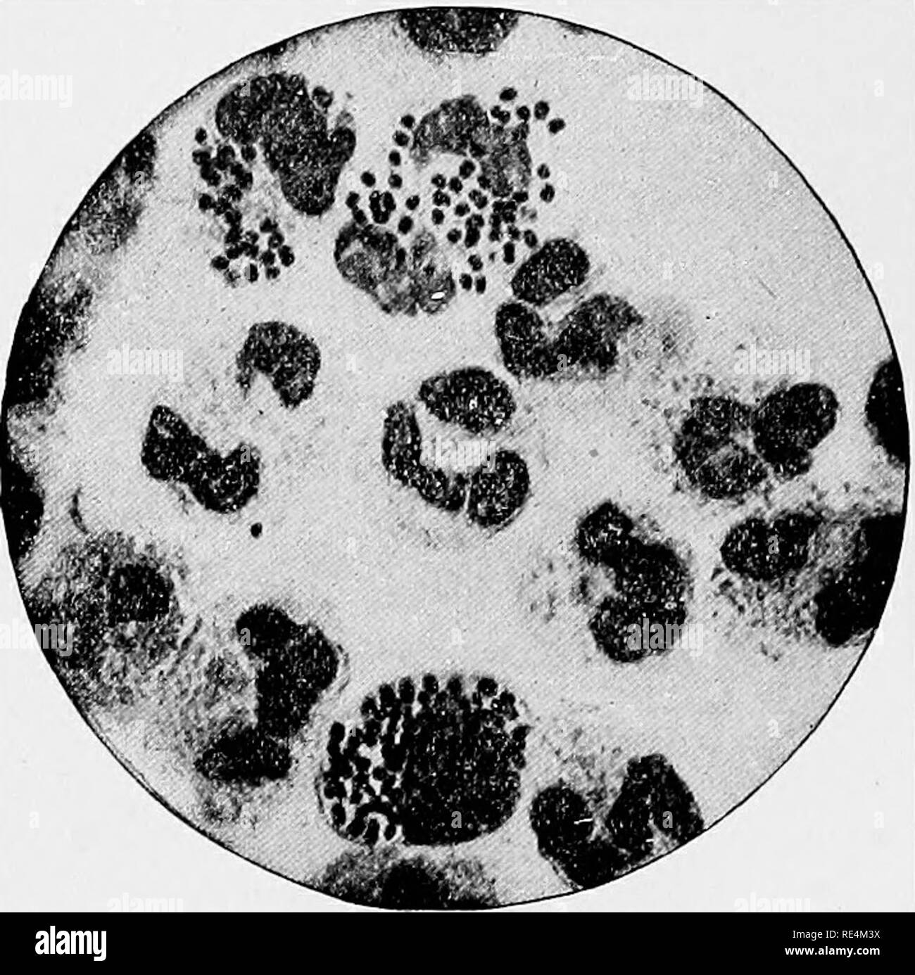 . Un libro di testo di batteriologia. Batteriologia. 392 PYOGENIC BATTERI. altri e separati da una fessura, e alcuni di questi corrispondono nella loro morfologia, in ogni dettaglio e con il gonococco." Macchie rapidamente con la base colori anilina, specialmente con violetto di metile, violetto genziana e fucsina; non così rapidamente con il blu di metilene, che è comunque una delle più soddisfacenti gli agenti di colorazione per dimostrare la sua presenza in presenza di pus. Bella doppia-colorati preparati possono essere fatte xrom gonorrheal pus e disteso su di un vetro di copertura e " iixed", secundum arte em, mediante l'uso di metilen Foto Stock