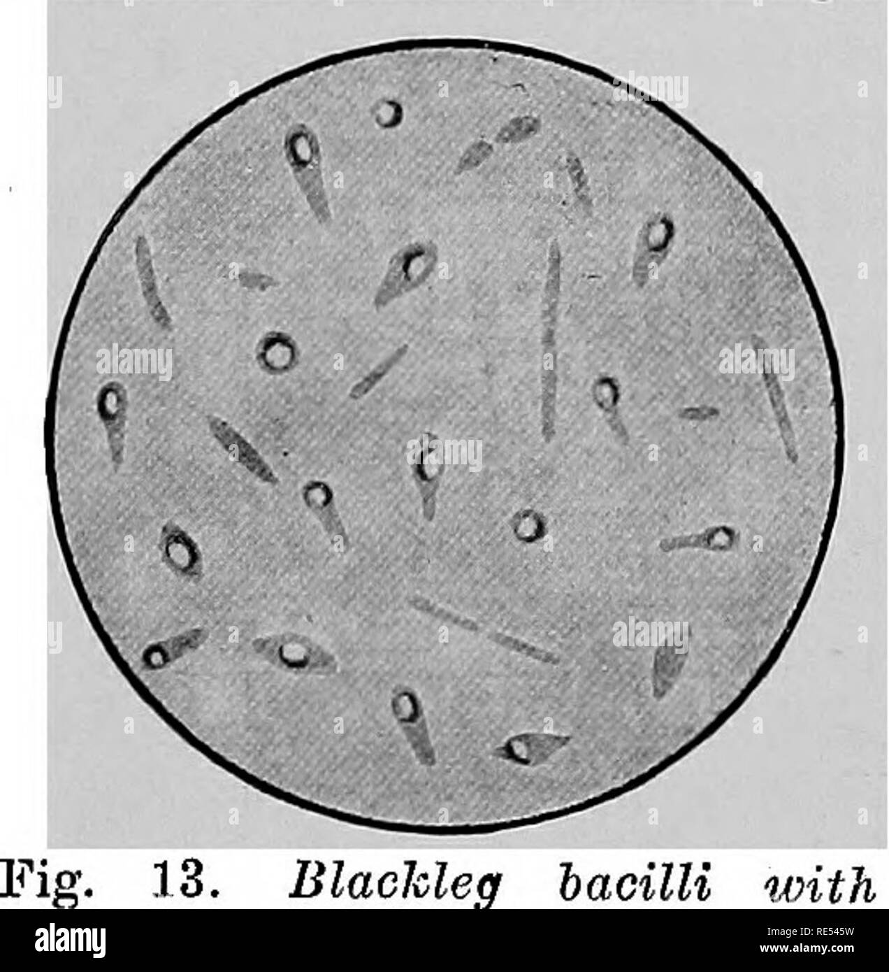 Flagella staining immagini e fotografie stock ad alta risoluzione - Alamy