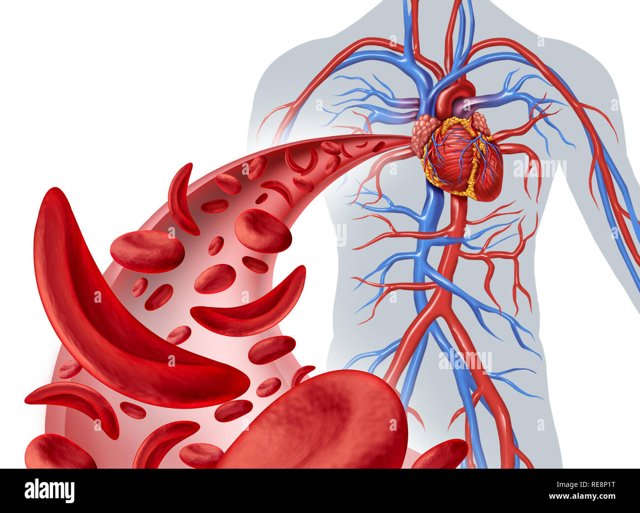 La falce cella circolazione cardiaca e anemia come una malattia con normale e di emoglobina anormale in una arteria umana anatomia con cuore cardiovascolari. Foto Stock