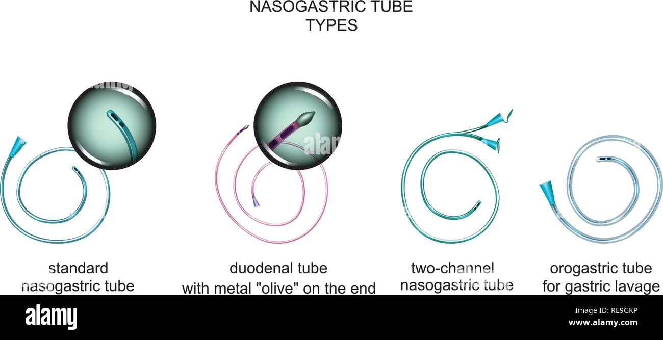 Illustrazione Vettoriale dei tipi di tubi di sondino nasogastrico Illustrazione Vettoriale