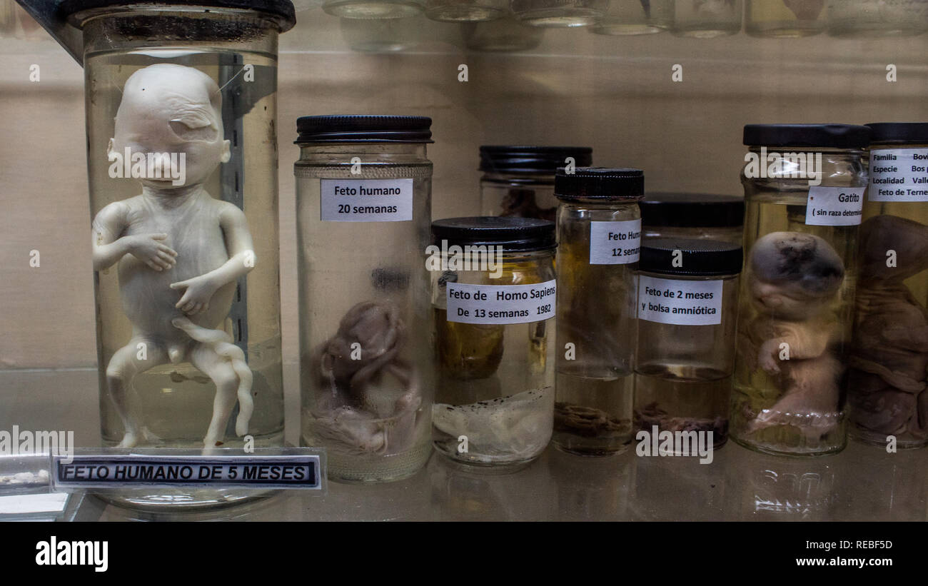 Mostra scientifica degli stadi di sviluppo dell embrione umano. Presentano primario è un 5 mesi feto abortito. La Salle Museo di Storia Naturale. Foto Stock