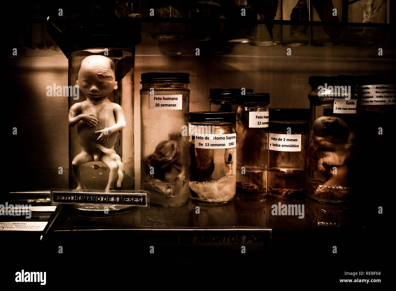 Una foto in bianco e nero di una esposizione scientifica degli stadi di sviluppo dell embrione umano. Presentano primario è un 5 mesi feto abortito. Foto Stock