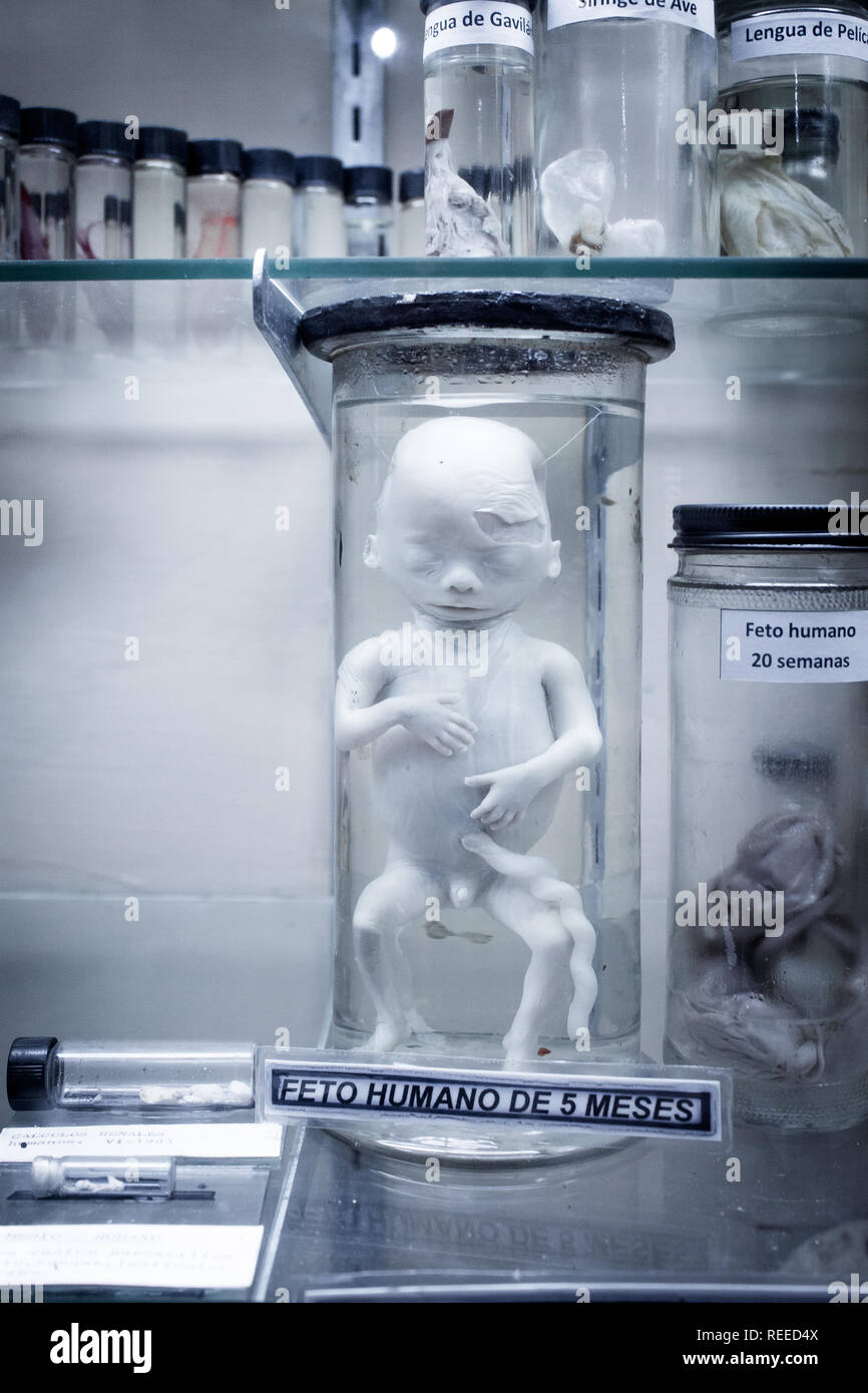 Una foto di 5 mesi di età del feto umano. Il provino è una parte della mostra scientifica presso La Salle Museo di Storia Naturale di San Jose, Costa Rica. Foto Stock