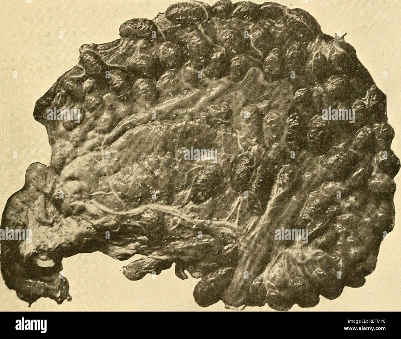. Comuni malattie degli animali della fattoria. Medicina veterinaria. Le malattie degli organi generativi 83 ciclomotore da diversi strati di membrane. La busta esterna, il corion, è esattamente adattato all'utero. La parte interna del enve- lope, l'amnion, racchiude il feto. Copertura della faccia esterna dell'amnion e fodera tho faccia interna del corion è una membrana doppia, la allantois. Le buste citate non sono l'unica protezione che la fa' tus ha contro gli infortuni. Jt è avvolto in fluidi come bene. Immediatamente circostante è. Fig. 19.-Placenta di mucca. Il liquor amnii, e nell'allantois Foto Stock