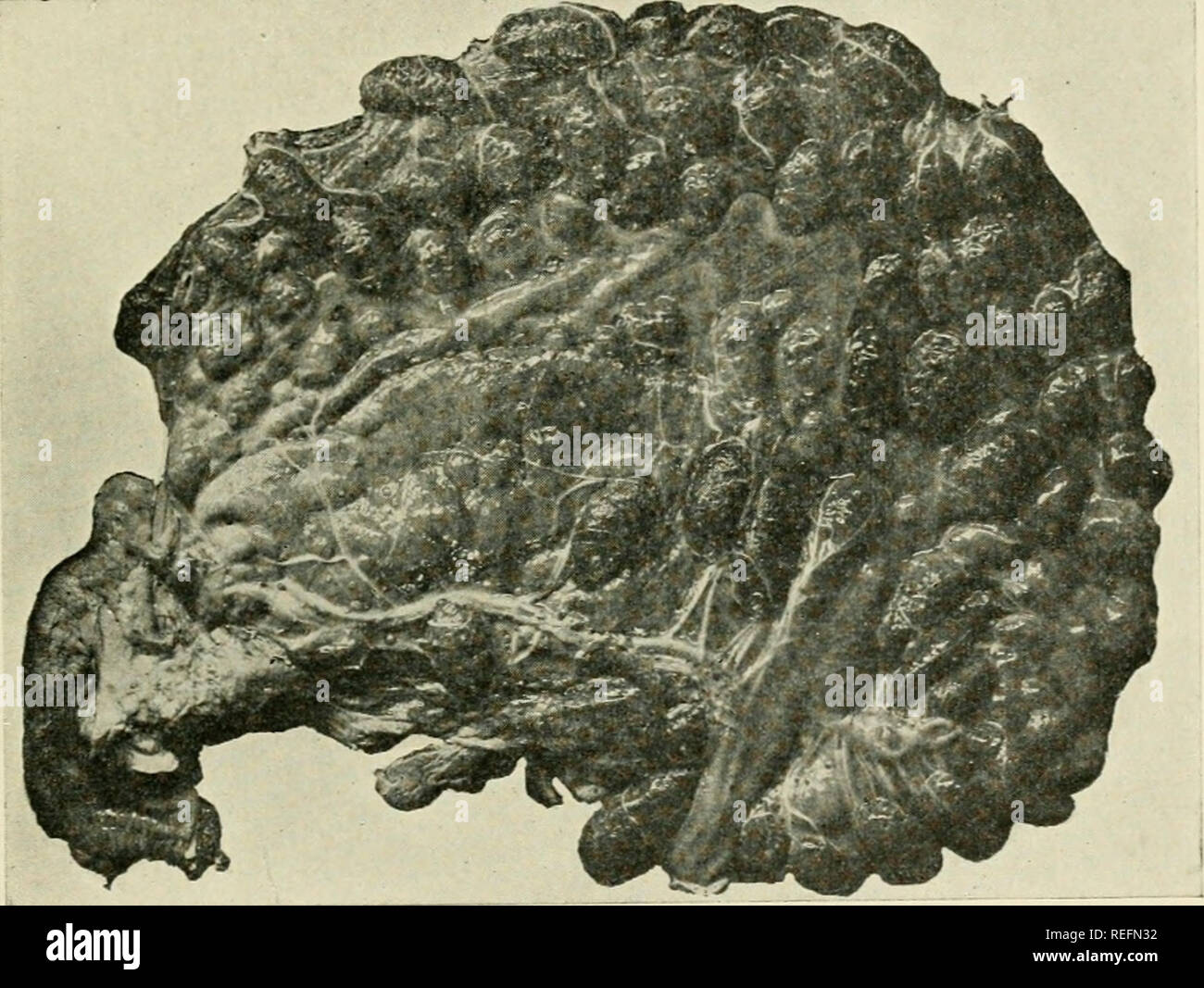 . Comuni malattie degli animali della fattoria. Medicina veterinaria. Le malattie degli organi generativi 83 ciclomotore da diversi strati di membrane. La busta esterna, il corion, è esattamente adattato all'lltel1^s. La parte interna del enve- lope, l'amnion, racchiude il fietns. Coverinii' la faccia esterna dell'amnion e il rivestimento della faccia interna del corion è una membrana donble, il allantois. Le buste citate non sono l'unica protezione che la fd'tns ha contro gli infortuni. Esso è avvolto in fluidi come bene. Immediatamente circostante è. Fig. 19.-Placenta di mucca. Il liquor amnii, e nell'Allan Foto Stock