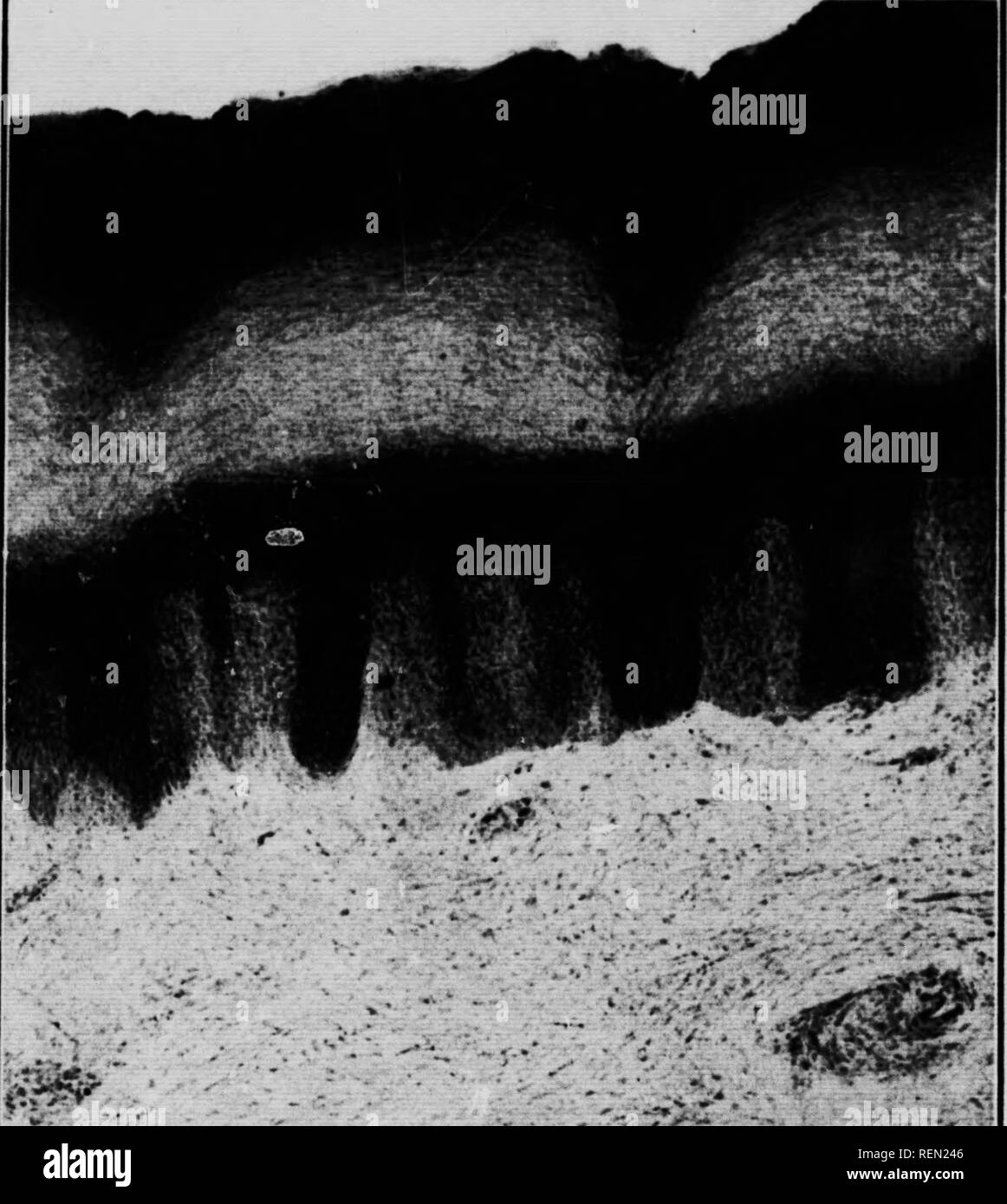 . La natura attraverso il microscopio &AMP; videocamera [microformati]. Storia naturale; La fotomicrografia; Sciences Naturelles; Photomicrographie. Â ¢. -^,. Â ND, 4;. Pelle IIIMW, VERIIlAI SKCIION. X 100. {A fiue /&GT;età 156.. Si prega di notare che queste immagini vengono estratte dalla pagina sottoposta a scansione di immagini che possono essere state migliorate digitalmente per la leggibilità - Colorazione e aspetto di queste illustrazioni potrebbero non perfettamente assomigliano al lavoro originale. Kerr, Richard, d. 1915. Toronto : Musson Foto Stock