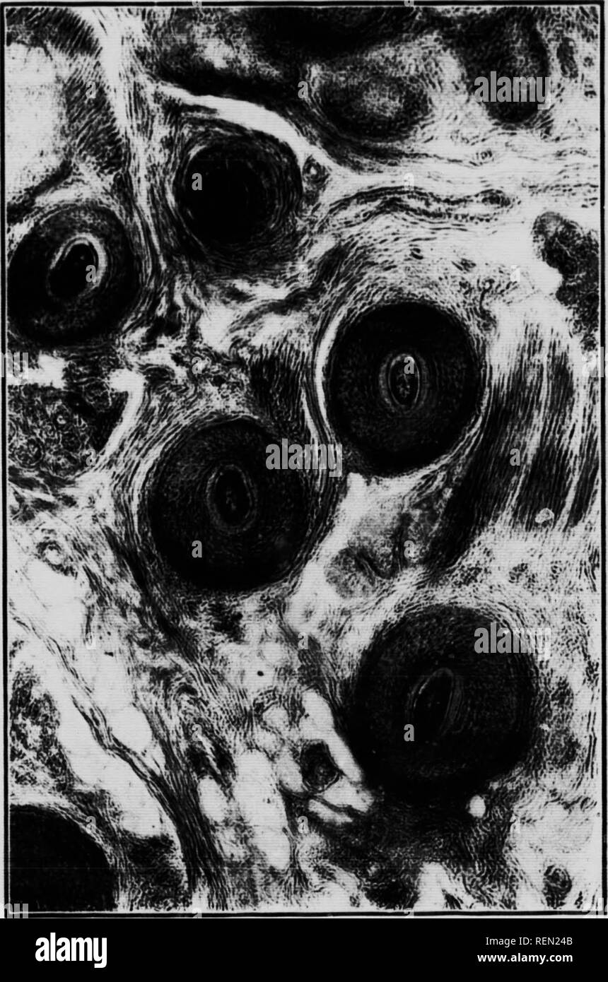 . La natura attraverso il microscopio &AMP; videocamera [microformati]. Storia naturale; La fotomicrografia; Sciences Naturelles; Photomicrographie. TRANSlCK--i; MXIIiiN OK HIMW TRUFFA'. &Gt;â lOO [a/AIF /'age 149.. Si prega di notare che queste immagini vengono estratte dalla pagina sottoposta a scansione di immagini che possono essere state migliorate digitalmente per la leggibilità - Colorazione e aspetto di queste illustrazioni potrebbero non perfettamente assomigliano al lavoro originale. Kerr, Richard, d. 1915. Toronto : Musson Foto Stock