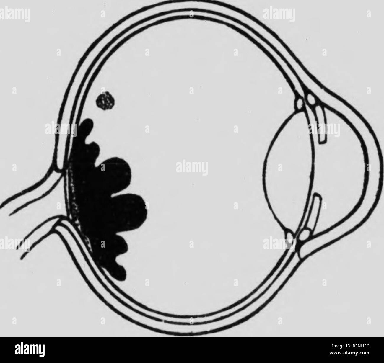 . Il fundus oculi degli uccelli, in particolare come si vede dall'oftalmoscopio [microformati] : uno studio nel confronto di anatomia e fisiologia. Ophthalmoscopy; occhio; Ophtalmoscopie; Oiseaux; Oeil; uccelli. Maiale. 25. Struzzo americano {Rhea americana). Si prega di notare che queste immagini vengono estratte dalla pagina sottoposta a scansione di immagini che possono essere state migliorate digitalmente per la leggibilità - Colorazione e aspetto di queste illustrazioni potrebbero non perfettamente assomigliano al lavoro originale. Legno, Casey A. (Casey Albert), 1856-1942. Chicago : premere sul lago Foto Stock