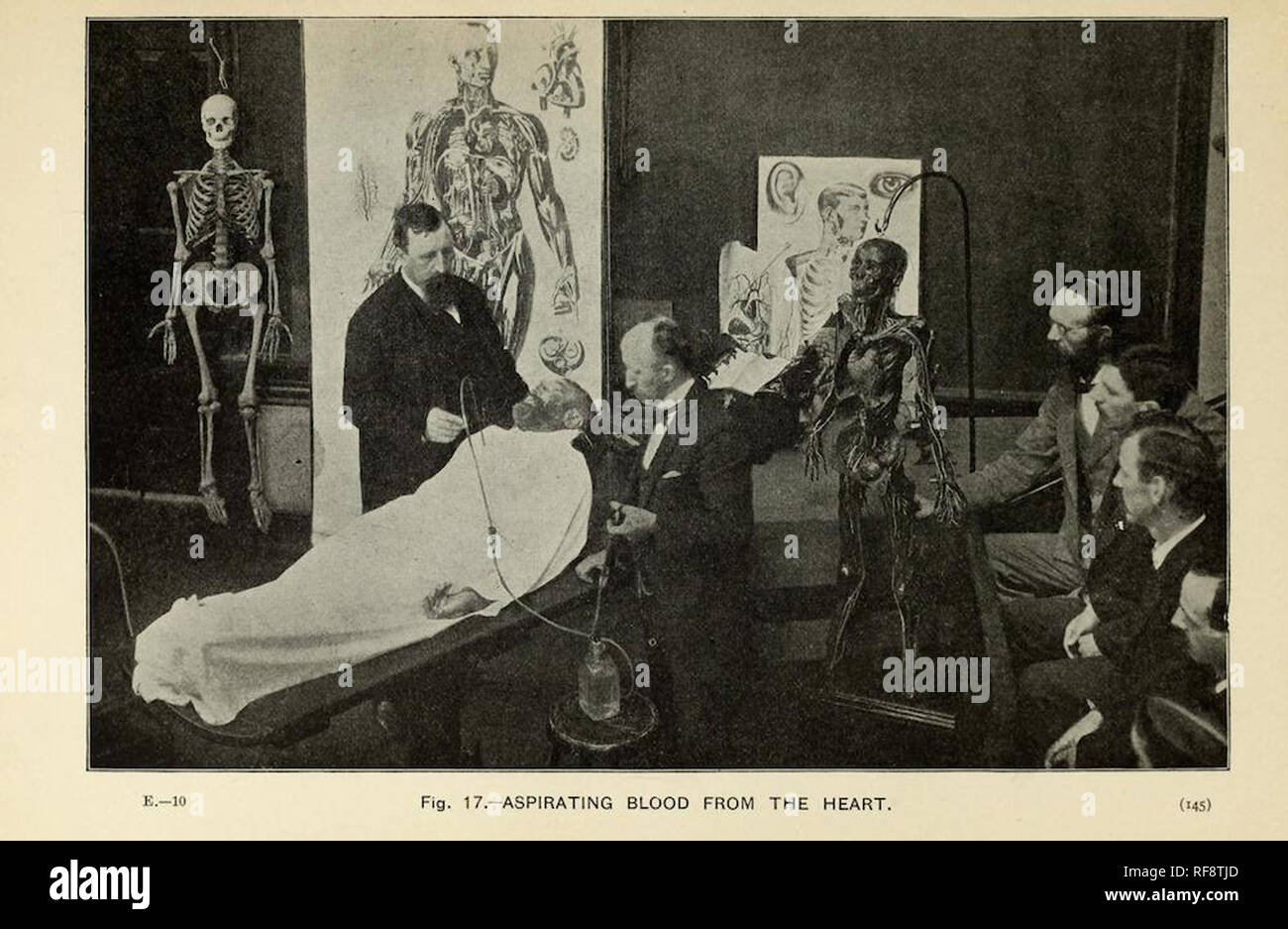Vintage fotografia vittoriano di scienziati medici e dottori studiando un cadavere Foto Stock