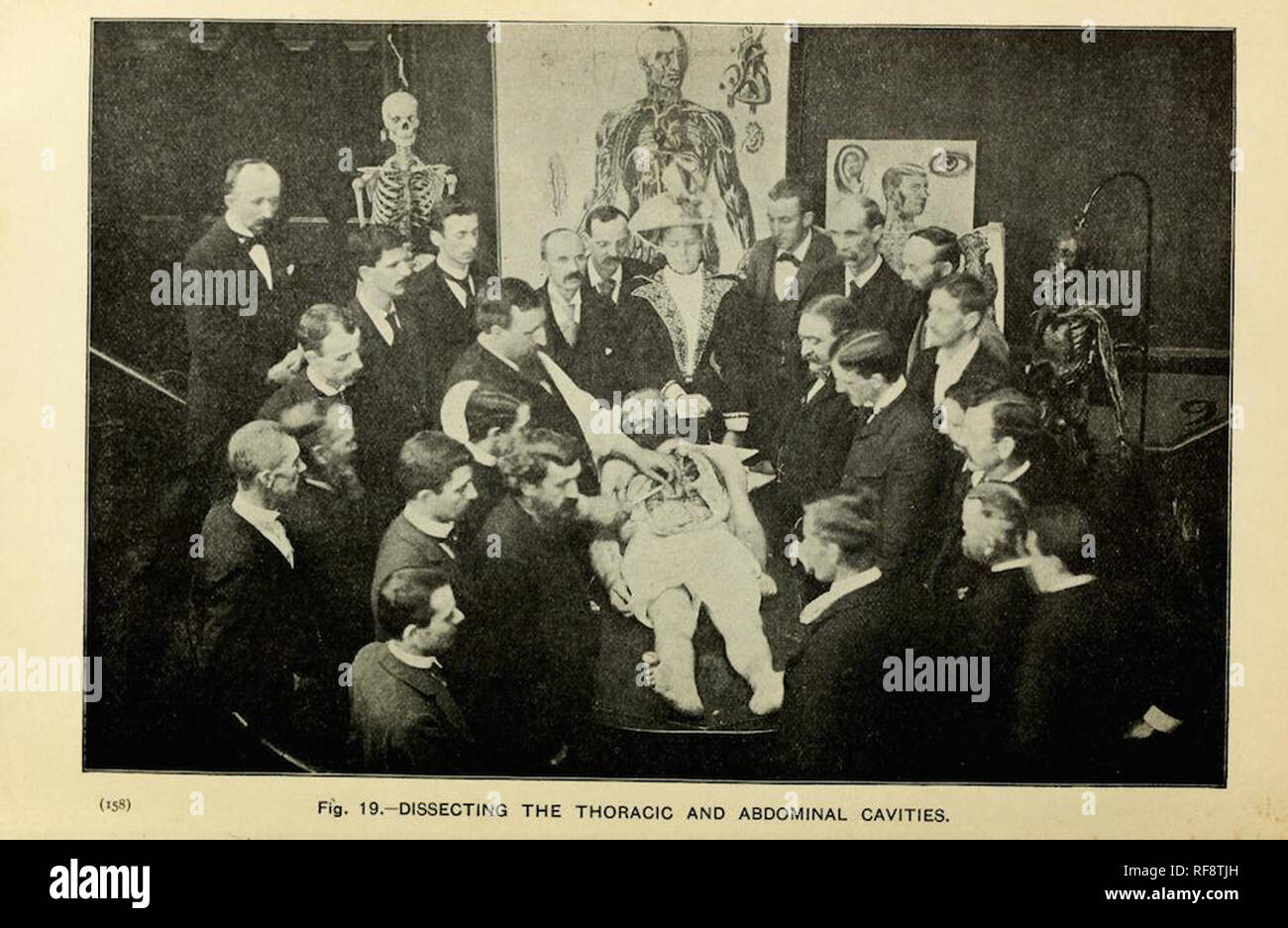 Vintage fotografia vittoriano di scienziati medici e dottori studiando un cadavere Foto Stock
