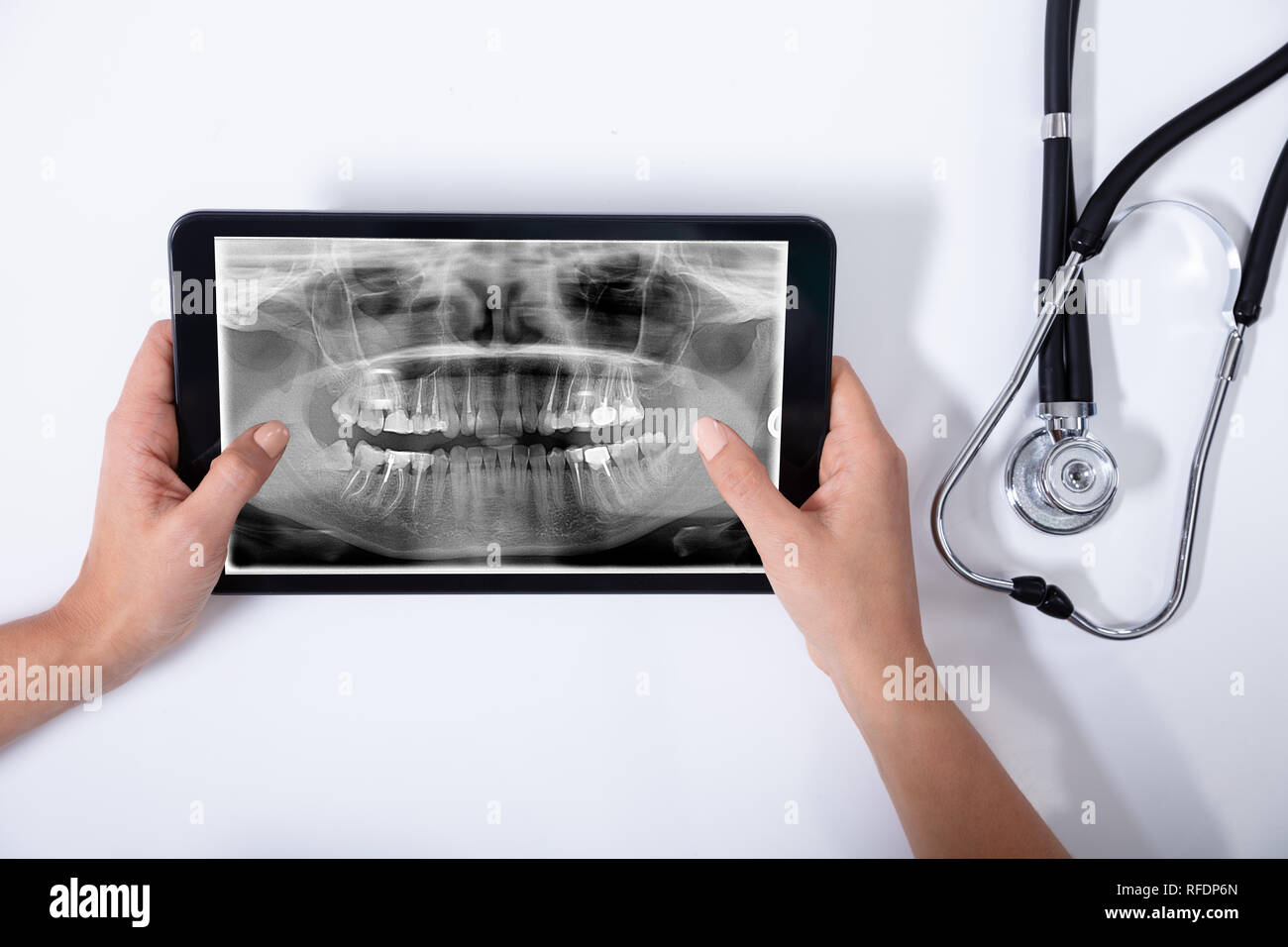 Close-up di medico tenendo tavoletta digitale con denti umani X-ray e uno stetoscopio su sfondo bianco Foto Stock