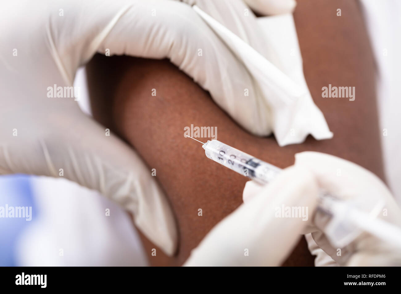 Close-up di un medico siringa di iniezione a maschio braccio del paziente in Clinica Foto Stock
