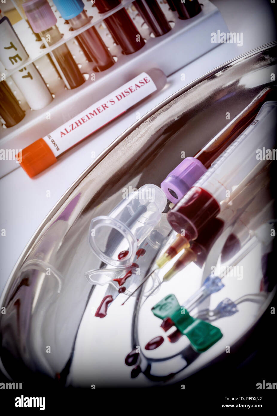Il campione di sangue da analizzare Porre rimedio contro il morbo di Alzheimer, immagine concettuale Foto Stock