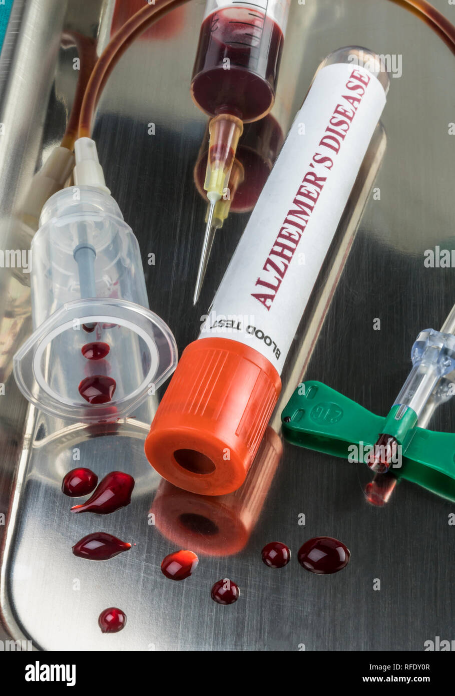 Il campione di sangue da analizzare Porre rimedio contro il morbo di Alzheimer, immagine concettuale Foto Stock