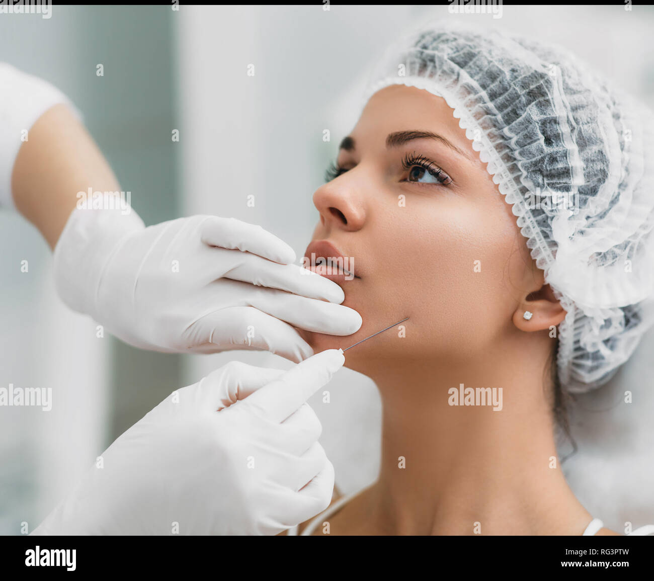 Estetista installa mesothreads nel volto di donna. Anti-invecchiamento procedure cosmetiche Foto Stock