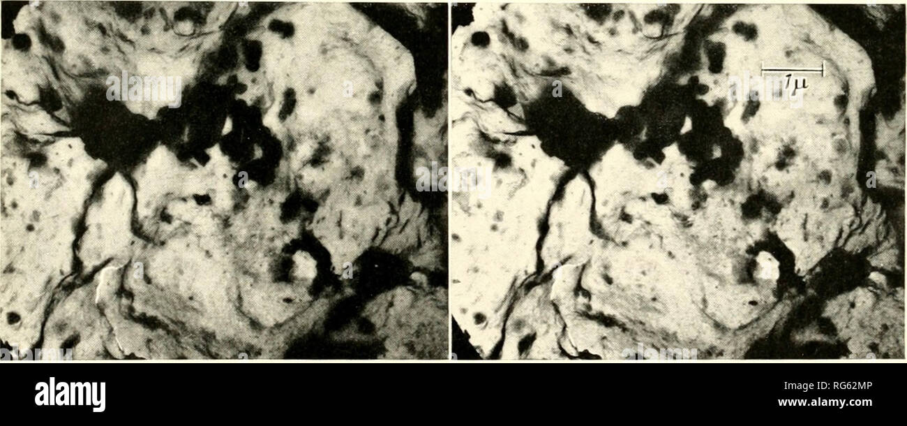 . I tessuti calcificati; procedimento. Osso; Collagene; calcificazione. J. Sui Lii-p.iir micrografie elettroniche di repliche (carlx'v .•; :"u' .;:itan.- nt dcx clopnv^ pii; I'liamel. Maguihcation originale . 5000. a) Guardando verso il basso sulla superficie fruni aboc, loiujI alla lett. Ci sono gobbe sollevate nel mezzo della cervicale i lati di alcune depressioni (che sono stati occupati da tomi' processi di ameloblasti); questi dossi sono probabilmente legate allo sviluppo dei prismi "all'interno di prismi", b) cercando fino in corrispondenza della superficie da sotto - da lo smalto del punto di vista. La concavità della cervica Foto Stock