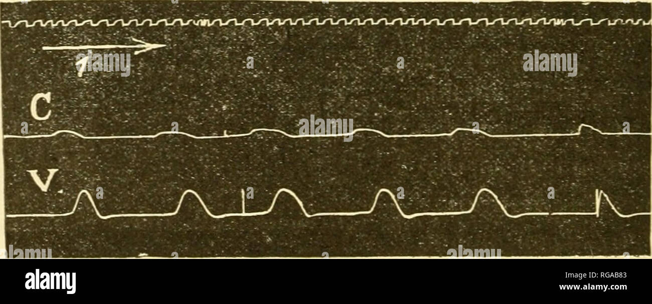 . Bulletins de l'AcadÃ©mie Royale des Sciences, des lettres et des beaux-arts de Belgique. Appreso le istituzioni e società e scienza. ( 444 ) irrÃ©guliÃ¨re. Dans certuni cas, ces tracÃ©s se produisent pendant une ou deux minuti, puis le cÅur s'arrÃªte; dans d'autres, la pression se relÃ¨ve au bout de quelques istanti, puis su obtient des tracÃ©s rÃ©guliers que je costitui- sidÃ¨re comme reprÃ©sentant les variazioni normales de pression dans le ventricule. Les premiers tracÃ©s pro- viennent de ce que l'entrÃ©e de la sonda dans le cÅur y produit des contrazioni anormales et irrÃ©guliÃ¨res. Dans Foto Stock