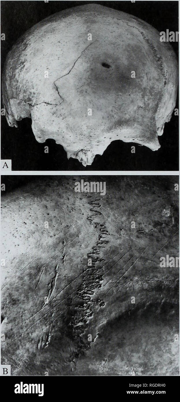 . Bollettino della Naturale Museo Histort. Geologia serie. Fig. 24 quattro viste di calvaria di umana. Un, vista laterale del bambino del cranio M54141 mostra cut-marchi e un marchio di percussione provocando ampie il cracking del cranio. B, vista frontale che illustra il taglio-segni all'interno dell'orbita. C, vista laterale del cranio 460a, che mostra segni di percusssion sovrapposti su cut-segna lungo il muscolo temporale di inserimento. D, vista posteriore del cranio stesso che mostra ampia cut-segni nella rotta regione occipitale.. Fig. 25 A, vista frontale del GC87 calotta mostra cut-segna in basso sull'osso frontale. B, dettaglio del parieta Foto Stock