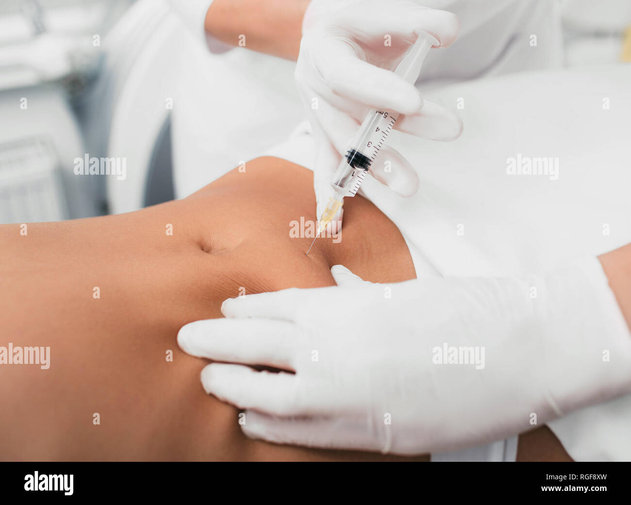 Iniezione nel ventre femminile, corpo mesoterapia. Estetista rimuovendo la cellulite sull'addome utilizzando iniezioni di bellezza. Foto Stock