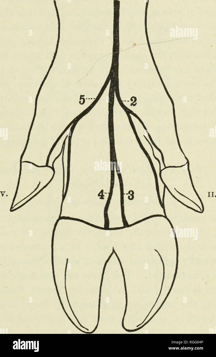 . Bollettino del museo di zoologia comparativa a Harvard College. Zoologia; Zoologia. PRENTISS: POLYDACTYLISM nell uomo e animali domestici. 2G9 rispettive cifre dividere, il più grande dei rami risultante che innervano le porzioni laterali della terza e quarta cifra. In pentadactyle animali (Carnivora e primati) nervo mediano dà oft' un quinto ramo radiale al 2 del maiale di Manus, che divide e alimenta il pollice e indice. No resti di un tale ramo del nervo potrebbe essere rilevato in le dissezioni del normale manus del maiale. n. m. IV. III. Fig. J. - Vista posteriore di sinistra normale Foto Stock