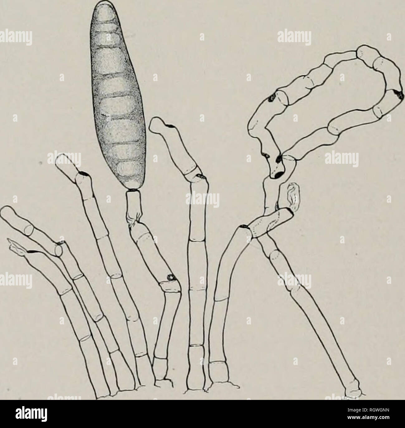 . Bollettino. Storia naturale; storia naturale. 109 diversi altri generi: Botrytis (Beauverie e Guilliermond, 13); alter- naria, Hpicoccum e Botrytis (Linder, 78); Inzengaea (Borzi, 23); De- matium. Botrytis, oidio (Klocker e Schiorming, 75); Chaetomium (treccia, 129, fig. 24, 25, A, B, Tab. 16). Il fenomeno descritto è sempre associato con la senescenza. Sclerozi sono descritti da Bakke (6) e da Noack, (87), che sembrano ha'e li foimd comune su paglia vecchia- culture, di lunghezza variabile da 200 a 600 p.. 1 non hanno trovato loro a tutti sulla paglia, sebbene su riso vecchi-culture sono Foto Stock