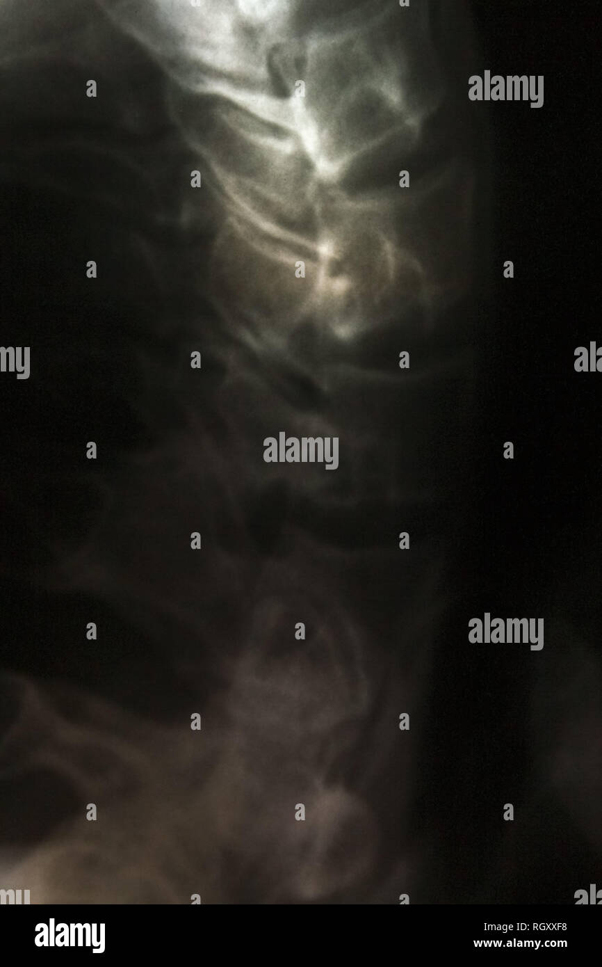 Immagine a raggi x di parti del corpo umano, x-ray foto, roentgen Foto Stock