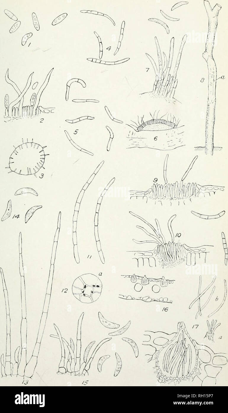 . Bollettino. L'agricoltura. Bui. 226, Ufficio di presidenza di impiantistica industriale, U, S, Dipartimento di Agricoltura. Piastra VI.. Specie di Colletotrichum, Cylindrosporium e Septoria su diversi host.. Si prega di notare che queste immagini vengono estratte dalla pagina sottoposta a scansione di immagini che possono essere state migliorate digitalmente per la leggibilità - Colorazione e aspetto di queste illustrazioni potrebbero non perfettamente assomigliano al lavoro originale. Stati Uniti. Ufficio di presidenza di impianti industriali. Washington : G. P. O. Foto Stock