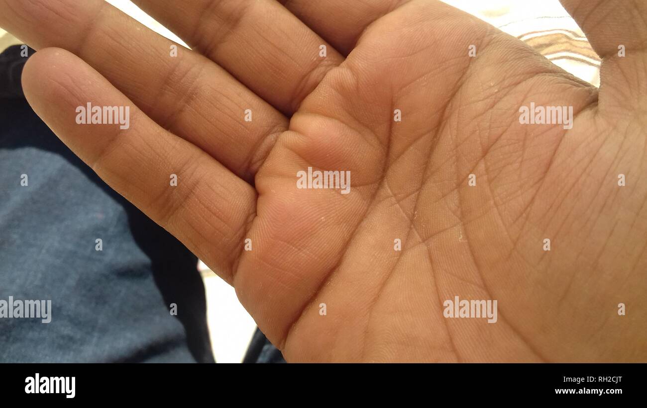L'immagine mostra un primo piano di un palmo umano aperto con pieghe cutanee visibili e una sottile secchezza tessutale sulla superficie della pelle Foto Stock