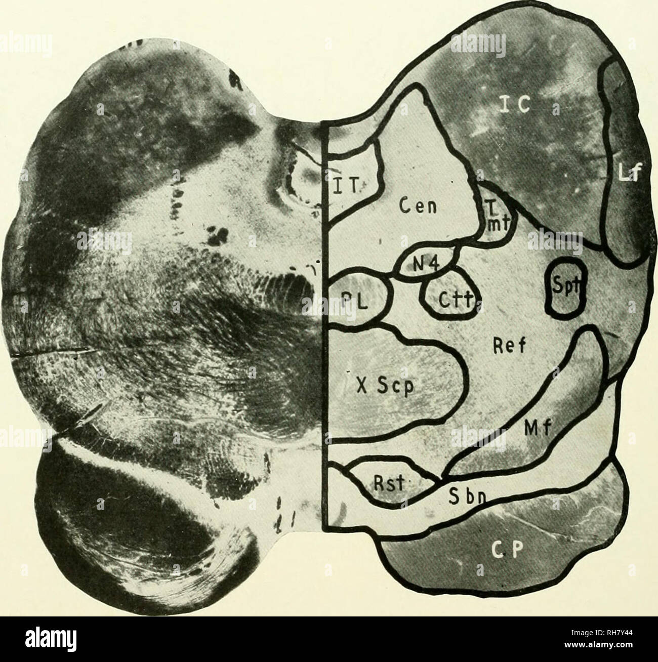 . Il cervello di scimmia all uomo; un contributo allo studio dell'evoluzione e sviluppo del cervello umano. Il cervello; evoluzione; Pongidae. 62 Il più basso livello di primati del COLLICULUS inferiore (fig. 32) a livello del collicuius inferiore, la comparsa di alcuni strikino; caratteristiche altera il conlicruration esterna dello stelo. Tra questi. FIG. 32. Lemure mongoz. Livello del COLLICULUS inferiore. CEN, centrale di materia grigia; CTT. Centrale tratto Tegmental; cp. Peduncolo cerebrale; ic, inferiore Collicuius; ESSO, Acquedotto di Sylvius; lf. Filetto laterale; mf. Filetto mediale; N4, Trocleare nervo; pl, Foto Stock