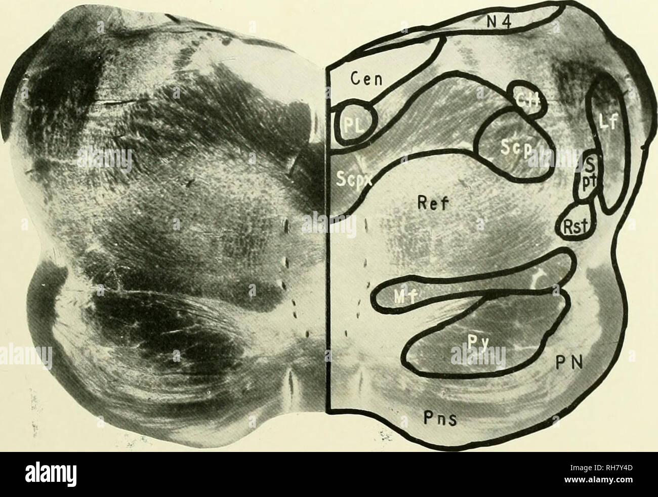 . Il cervello di scimmia all uomo; un contributo allo studio dell'evoluzione e sviluppo del cervello umano. Il cervello; evoluzione; Pongidae. Lemure MONGOZ 6i e la centrale di materia grigia (CEN), immediatamente al di sotto del pavimento del quarto ventricolo, è una piccola collezione di medie dimensioni nerve ceUs con- stituting il nucleo di von Bechterew (NBE) che è uno del gruppo del. FIG. 31. Lemure mongoz. Livello di emergere del nervo trocleare. CEN, centrale di materia grigia; CTT. Centrale tratto Tegmental; lf, filetto laterale; mf. Filetto mediale; N4, Trocleare nervo; PL, longitudinale posteriore Fasciculus; pn, Pontil Foto Stock