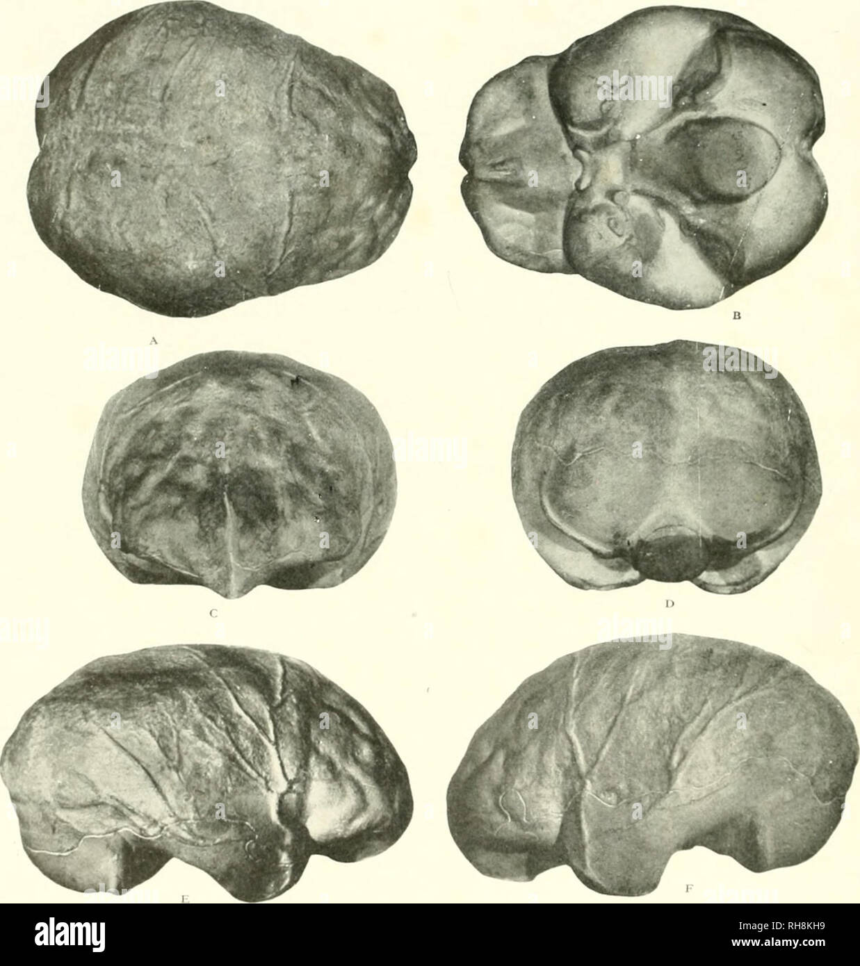 . Il cervello di scimmia all uomo; un contributo allo studio dell'evoluzione e sviluppo del cervello umano. Il cervello; evoluzione; Pongidae. Figg. 366 a 371. Sei MEWS OI- ENDOCRAMAL CAST DI PITHECAN- THROPUS ERECTUS (IAVAN APE-.L'uomo) il più noto PRIMIIIXF offrono sentative della famiglia umana. Stimato ANIiyLII'i fossili di 500.000 anni. 1 RESTOKA lONK B'l PROF. J. H. MCGREGOR. (A) Vertex, (d) Base ripristinata. ((;/ ItdiUmI Pole. M)) Oeei|)it.il polo, (e) Riglu Surfaee laterale. (1) a sinistra della superficie laterale. Il frontale convoluzioni e br.inclies del medio meningeal arteria sono particolarmente ben Foto Stock
