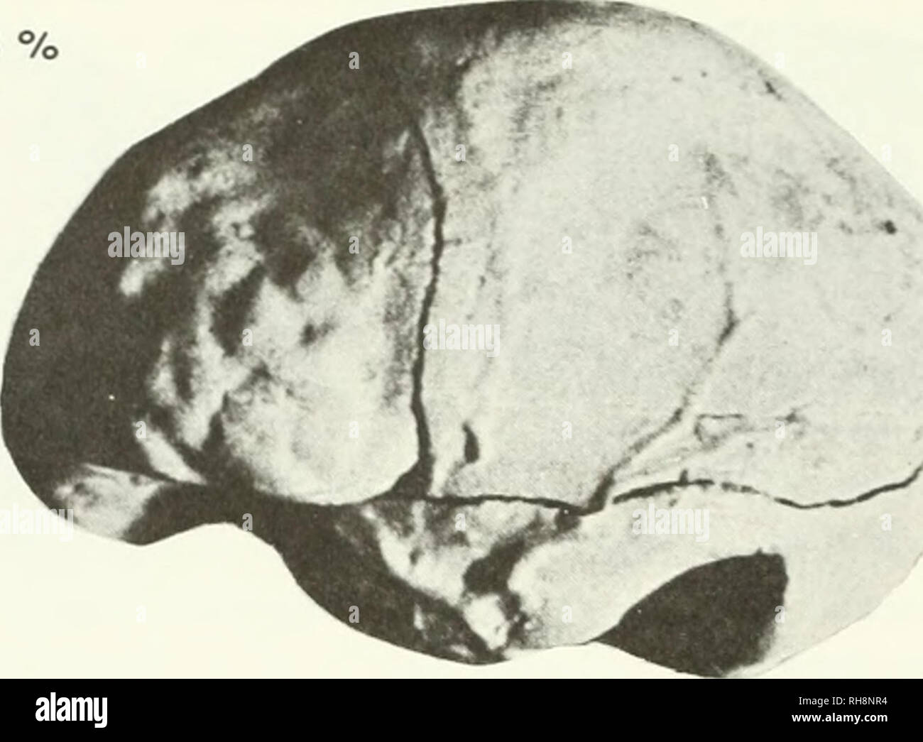 . Il cervello umano in evoluzione. Evoluzione umana; il cervello; ominide fossile. Vk- °^. 563 c.c. 1030 c.c. Figura 19: biparietale endocast parziale e totale endocast di Homo erectus peki?ie?isis II da Choukoutien, Cina. stima, ossia S.D. = 50 c.c). Entrambi questi valori superano in numero di S.D.s eccedenti la media, il numero massimo di valori calcolati per vivere hominoids (vedere tabella 7), vale a dire +3.88 e +3.78 per uomo, +3.89 o + 3,81 per i maschi di gorilla e +3.75 per il maschio e la femmina di gorilla. In relazione alla mia stima del A. africanus media (494 c.c), H. habilis eccesso di 3,93 S.D.s appena Foto Stock