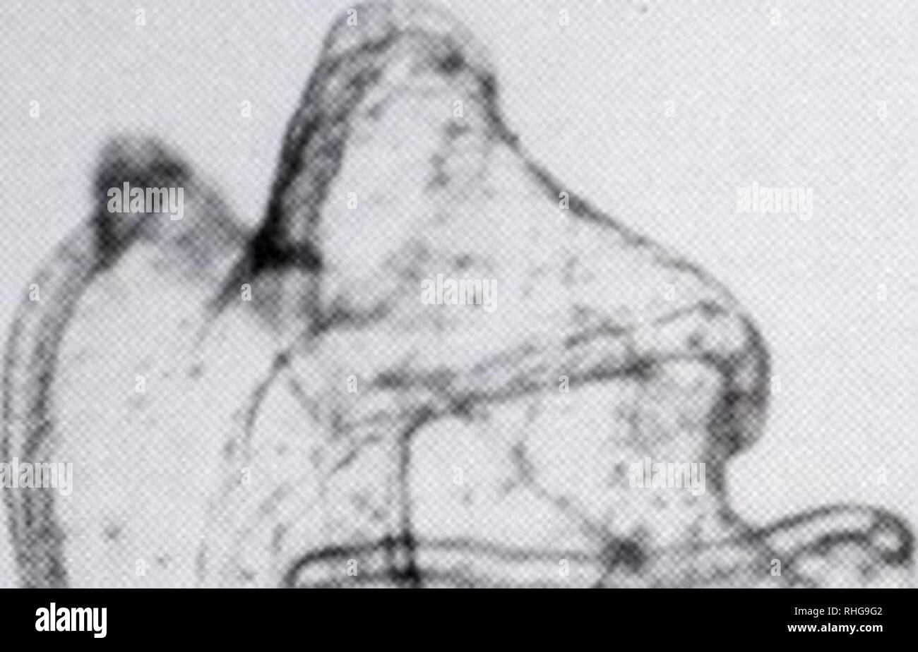 . Il bollettino biologico. Biologia; Zoologia; biologia; biologia marina. n se N strutture essenziali sono i componenti del corpo che infine formano la cavità del corpo in organismi adulti, in definitiva sur- arrotondamento del digestivo e organi riproduttivi. Coelomo- cytes (situato nell'coelom) sono stati riportati per partecipare ai processi rigenerativi in adulti di echinodermi (Thorndyke ct ai, 1999). In contrasto, abbiamo trovato che le larve bisecato, privo di sacche coelomic nelle loro regioni anteriore, completata la rigenerazione. Così, coelomocytes apparentemente non giocano un ruolo critico nella rigenerazione delle larve. In pazienti adulti Foto Stock