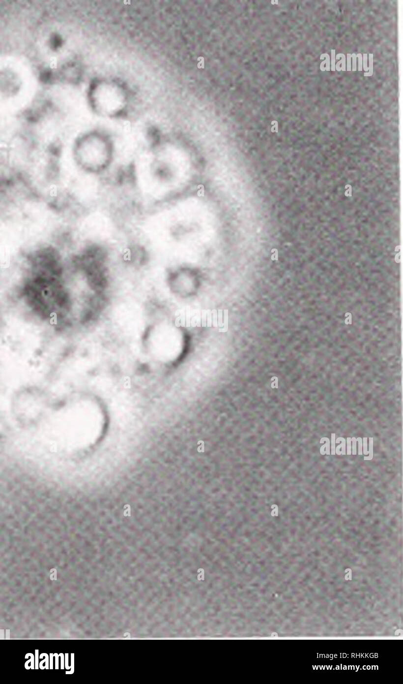 . Il bollettino biologico. Biologia; Zoologia; biologia; biologia marina. 444 D. M.C. Carni di montone e V. J. SMITH : V*- 1a 1b. La figura 1. Amoehocyles oi Actinui cqinna isolato da filamenti mesenterica alter 45-min incuba- tion su vetrini coprioggetto in vetro. (A) una diffusione di ialina fagocitiche () tipo cellula contenente numerose piccole, solitamente nonrefractile, inclusioni. Barra di scala = 5 ^m. (H) un intatto di cellule granulari contenenti molte grandi e altamente re- tractile granuli. Barra di scala = 5 ^m. è stato memorizzato su ghiaccio fino all'uso. Proteina in il sistema ALS è stato deter- minato mediante il metodo di Bradford (1976) con albumina di siero bovino come standa Foto Stock