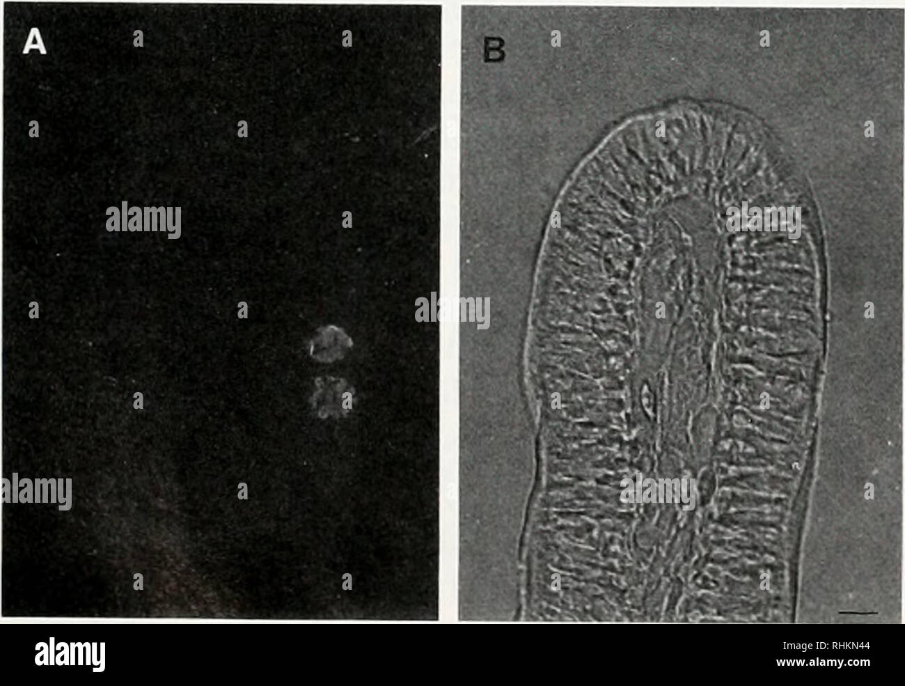 . Il bollettino biologico. Biologia; Zoologia; biologia; biologia marina. La figura 5. Double-label, immunofluorescenza Micrografia di un'in- testinal cellule epiteliali di Anguilla japonica incorporante Vihrin fisso anguillarum in vivo. Fissato il Vibrio anguillarum (0,5 mg) sono state iniettate nel lume dell'intestino. Trenta minuti dopo, le cellule intestinali sono state separate, fisso e trattata con metanolo. Dopo il legame con 8F1- tibody, le cellule sono state marcate con rodammina-coniugato igg di capra anti-Ig di topo(G + M) e di coniglio anti-I'/Vir/o antisieri anguillarum e infine con FITC-coniugato igg di capra anti-Rab Foto Stock