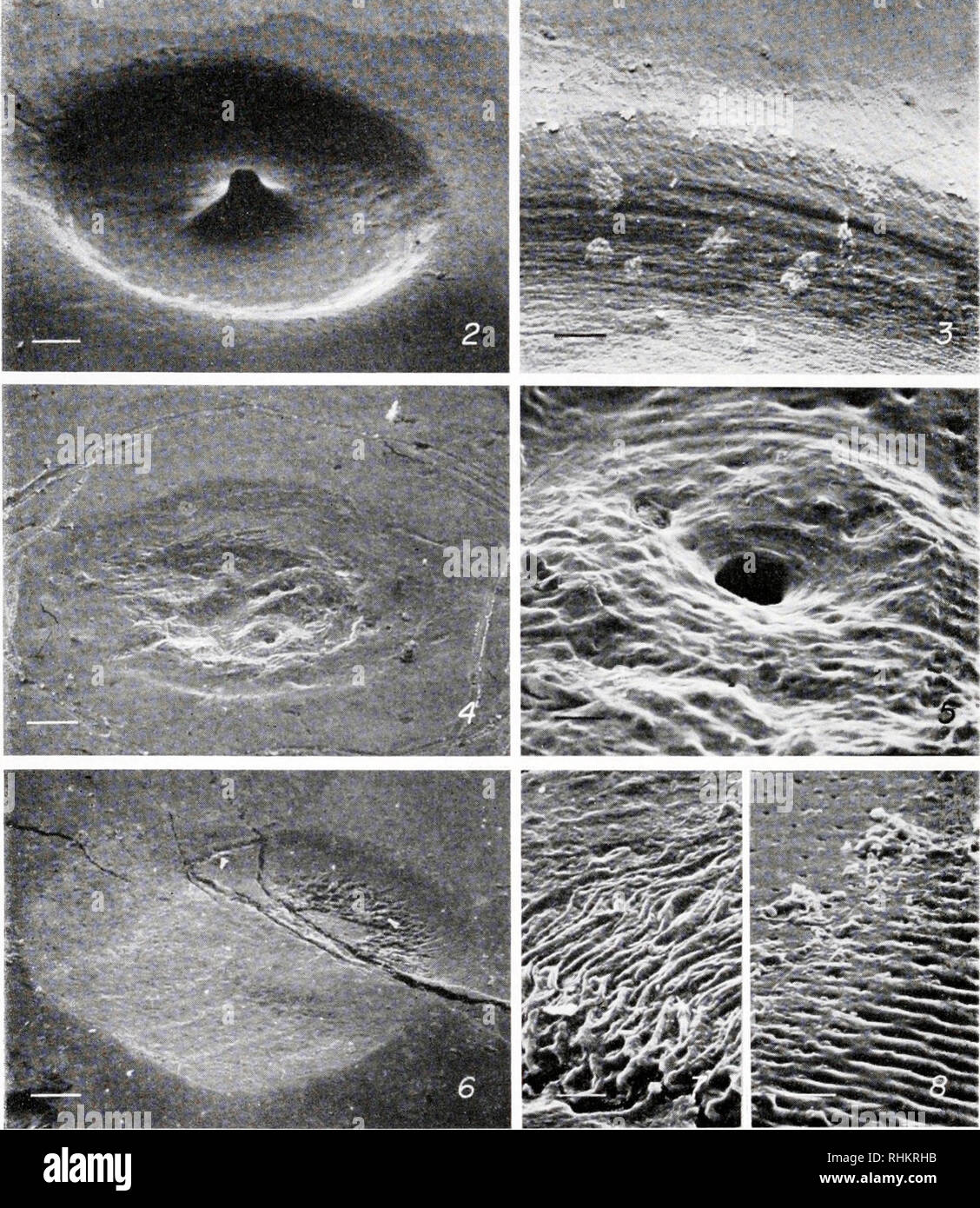 . Il bollettino biologico. Biologia; Zoologia; biologia; biologia marina. 510 CARRIKER, Van Zandt e concedere l. Le figure 2-20 illustrano micrografie elettroniche di scansione. La figura 2. Foro incompleto nel guscio di Anomia simplex. Barra di scala è uguale a 0,2 mm. La figura 3. Porzione di bordo smussato del foro di trivellazione in figura 2. Barra di scala è uguale a 0,05 mm. La figura 4. Foro di trivellazione poco profonda in carni bovine osso. Piccoli fori di trivellazione sono Haversian canali. Barra di scala è uguale a 0,13 mm. La figura 5. Ingrandimento di un Haversian canal nel foro di trivellazione in figura 4. Barra di scala è uguale a 20 jum. La figura 6. Foro di trivellazione poco profonda nel dente umano. Abbassare la porzione sinistra del foro Foto Stock