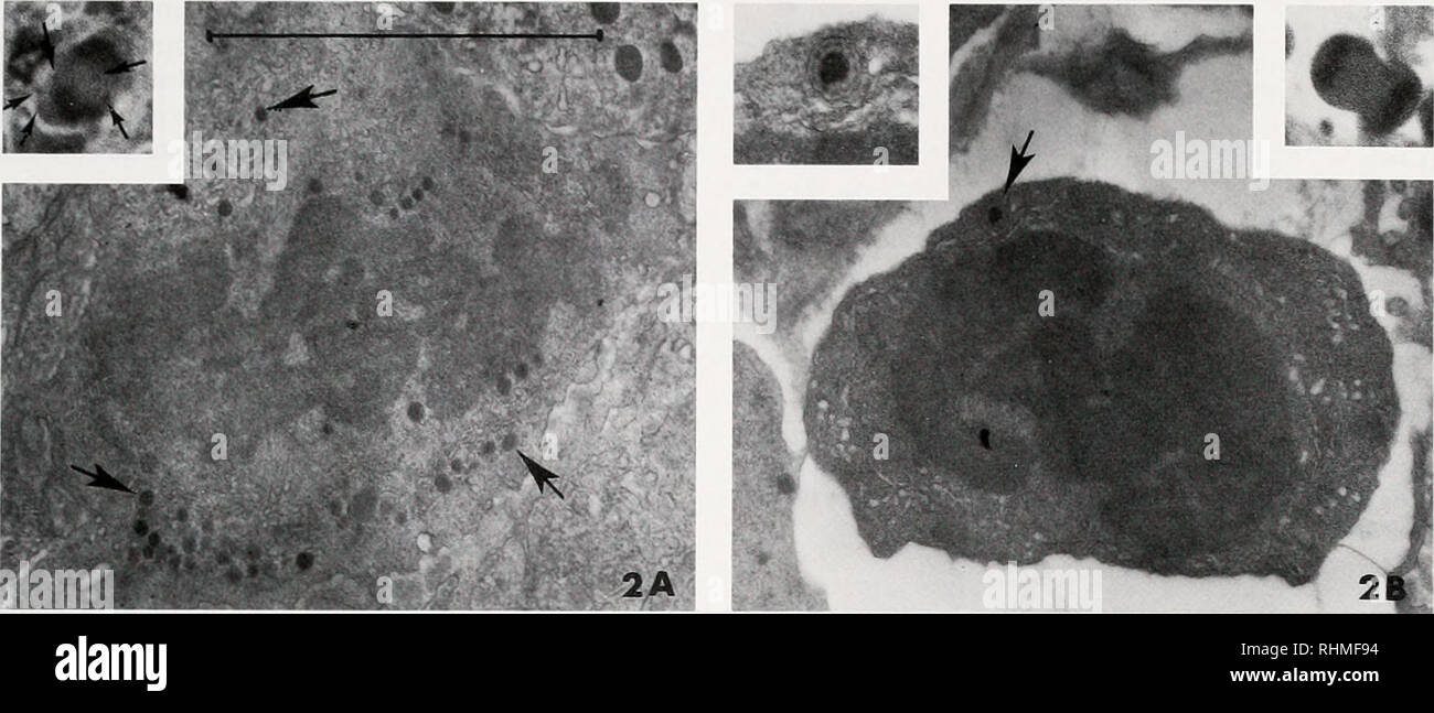 . Il bollettino biologico. Biologia; Zoologia; biologia; biologia marina. L'ematopoiesi e MUTA IN DECAPODI 191. La figura 2. Le micrografie micrografie a trasmissione di elettoni e micrografie lighl (inserti) di cellule in divisione. Mandrino e microtuhules centrioles non sono visibili nelle micrografie elettroniche, rifugio sia cellule mancano le buste nucleare. (A) Granulociti cellule staminali in metafase; inserto mostra una cella in anaphase (frecce = granuli). (B) cella ialina in prophase o metafase. Inserto di destra mostra una cella in telophase sinistra e inserire la stessa cella con un ingrandimento maggiore (17.600 cui si aggiunge*) tipica di un granulo con una striate Foto Stock