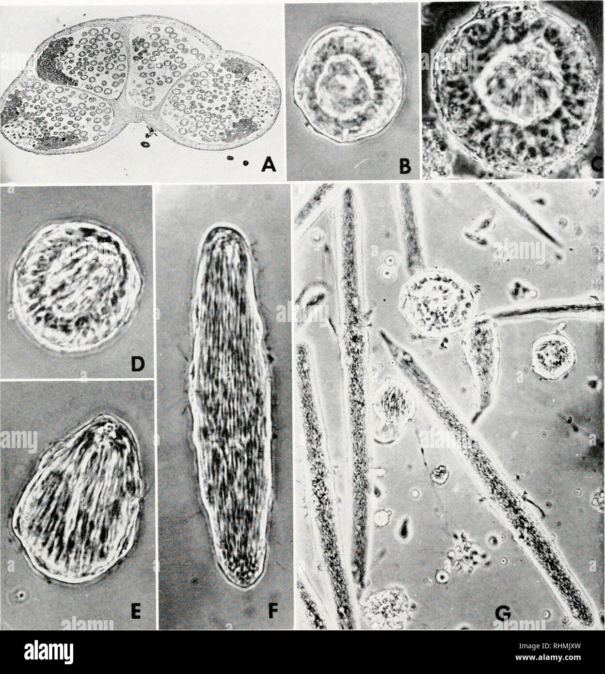 . Il bollettino biologico. Biologia; Zoologia; biologia; biologia marina. IN VITRO la spermatogenesi 529. La figura 1. Con l'eccezione di figura 1A (che è una sezione di un fissate e colorate per la preparazione), tutti gli altri mezzi toni qui e in figura 4 sono di contrasto di fase fotografie di culture viventi. (A) la sezione del testicolo di un diapausing Cynthia pupa; il germinal cisti occupano le quattro camere formate dalle inflessioni dello strato interno delle pareti testicolare (40 X). (B) un tipico germinal cisti rimossa da un diapausing Cynthia testicolo. Il pri- maria spermatocytes circondano il lume centrale a Foto Stock