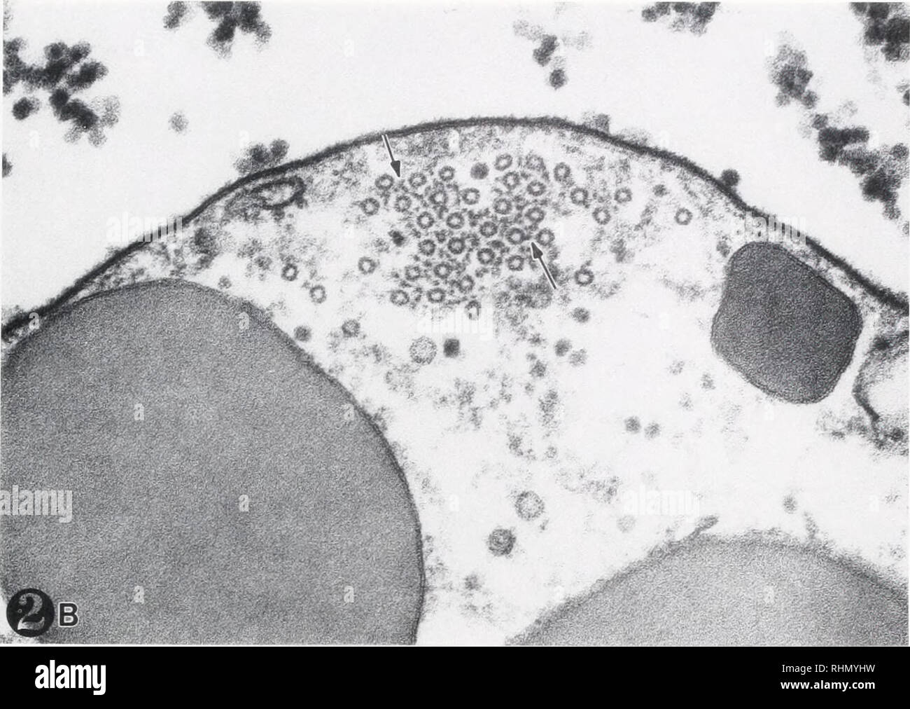 . Il bollettino biologico. Biologia; Zoologia; biologia; biologia marina. LIML'LIS AMEBOCYTE CITOSCHELETRO 421. La figura 2B. Un ingrandimento maggiore del marginale microtuhule mano (MB) in sezione trasversale. Le sporgenze possono essere visto che porta da una microtubula all'altro (". Questi risalti possono servire per stabilizzare la MB e sono probabilmente legati al microtubulo proteine associate presenti in altri sistemi. • 104.000. ization del MB si è verificato solo nella endotossina-cellule attivate. Profili nucleare Amebocyte nuclei delle cellule studiate sotto tutti e tre con- ditions (nativi, attivato e di endotossina attivata) aveva Foto Stock