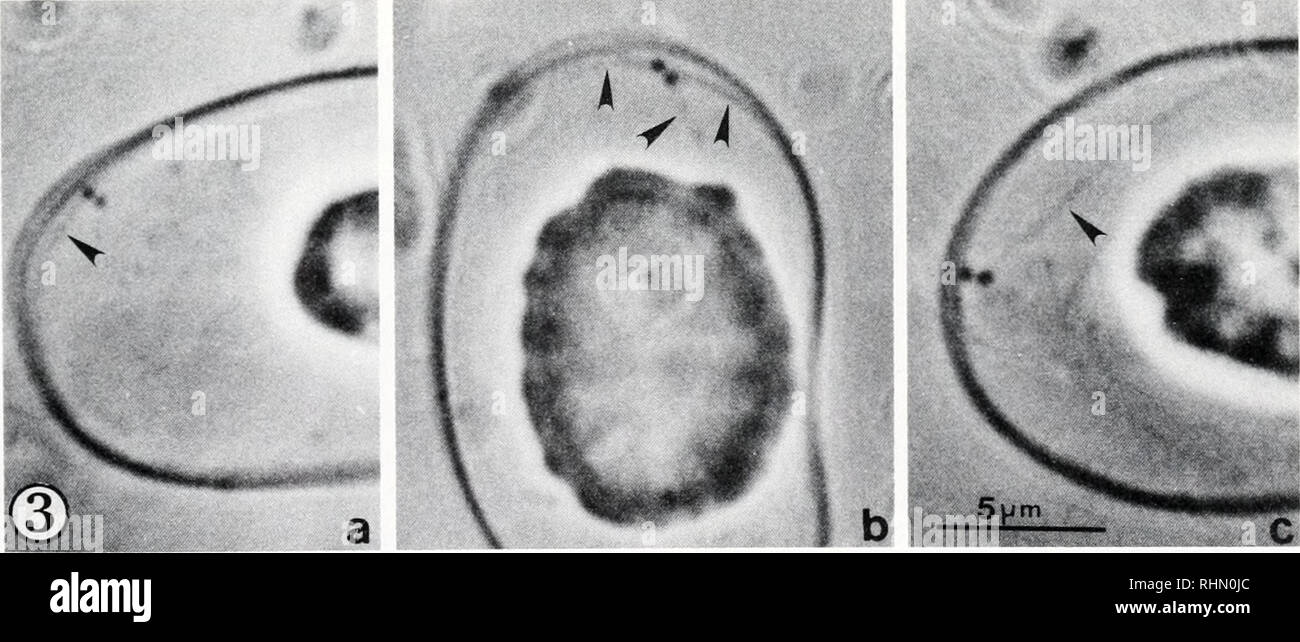 . Il bollettino biologico. Biologia; Zoologia; biologia; biologia marina. La figura 2. Pattino cytoskeletons eritrocitaria (Triton X-100) lisi, come osservato in contrasto di fase in olio da immersione. Centrioles vengono visualizzate appaiate, fase densa "puntini" (frecce), (a) uno dei centrioles molto vicino a oppure in contatto con MB; N = nucleo, (b) Centriole coppia adiacente, ma non in contatto diretto con la parte principale di MB; (c) centriole coppia apparendo a toccare MB, con un "fibra" (F) estendentesi in allontanamento da esso. Alcune delle coppie centriole si trovano ad essere attaccata a fibre (fasci di microtubuli) che Foto Stock