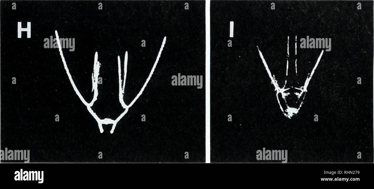 . Il bollettino biologico. Biologia; Zoologia; biologia; biologia marina. La figura 3. (A| Bipinnana di Aatcnmi muuala, (B) auricularia di Parastichopus californicus, (C, D, E) Vista del lato ampio e (F) Vista del lato stretto del ossicoli nella parte posteriore di sinistra del corpo di P. californicus, (G) e (H) ophiopluteus ofOphiiira Tarso, (I) echmopluteus ofDendrasterexcentricus. Cal- cite scheletri mostrato con filtri polarizzanti parzialmente attraversato in (C) e (G) e completamente attraversato in (D, E, F, H, I). Barra di scala è 400 ^m in (A, B. G.H.I) e 160/imin(C, D. E, F). Tra echinoplutei, la fase di sviluppo Foto Stock