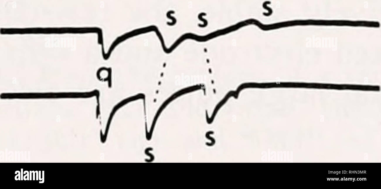 . Il bollettino biologico. Biologia; Zoologia; biologia; biologia marina. V q. La figura 7. Le modifiche delle forme d'onda di SMPs (s) e QSCPs (q) associato con la profondità della registrazione una punta di elettrodo (traccia superiore). Traccia inferiore è l'elettrodo di riferimento sulla superficie. Una, superficie; B, 460 /tm; C, 360 /mi; D, 310 /urna; E, 210 /mi; F, 110 /mi; G, 60 /mi; H, 40 /mi; I, 20 /im J, superficie. Siti originari di SMPs spesso cambiato; nella prima coppia di . è apparso prima nella traccia inferiore ma nella seconda coppia, l'ordine è stato invertito, linea mostra le possibili coppie di impulsi. Tutti gli impulsi sono stati evocati dalla terminazione li di adattamento Foto Stock