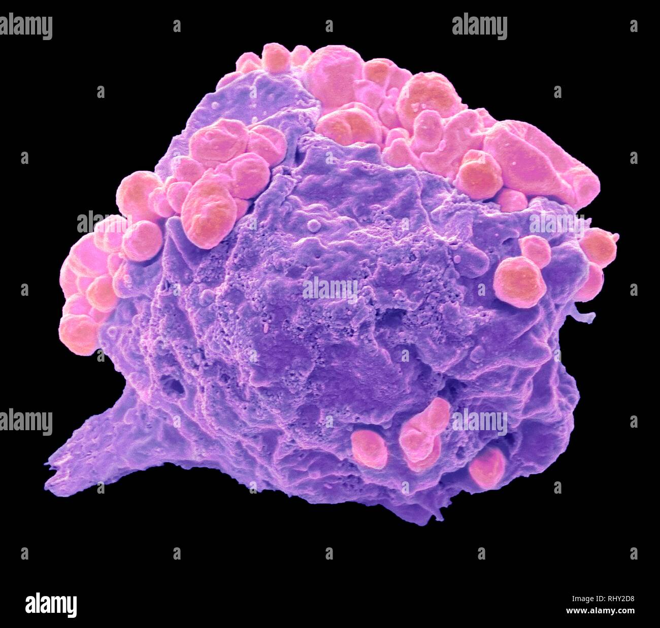 Linfoma di cellule di cancro, SEM Foto Stock