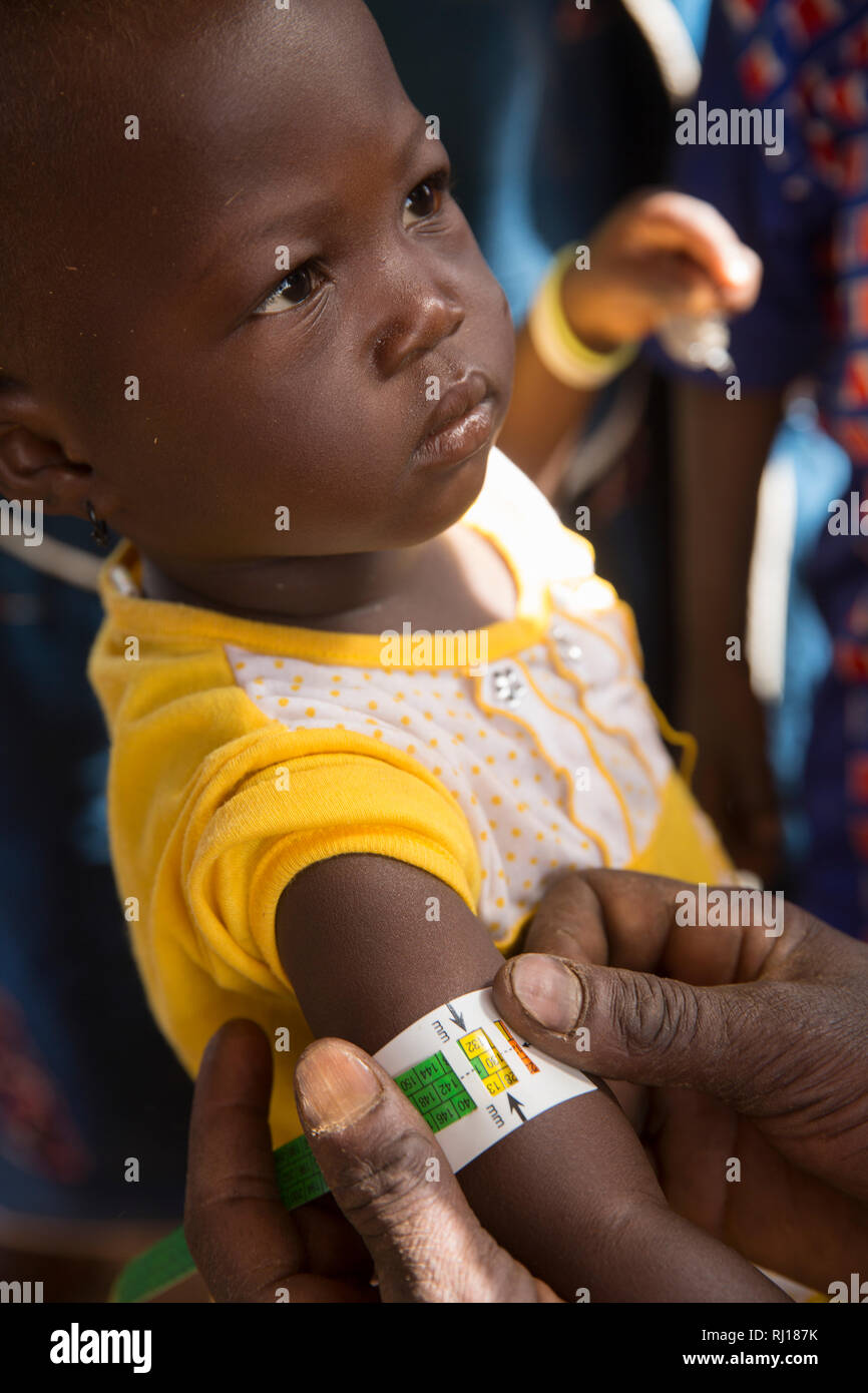 Il villaggio di Samba, Provincia Yako, Burkina Faso. CVN team nutition controllare i bambini per indicazioni su malnutition. Foto Stock