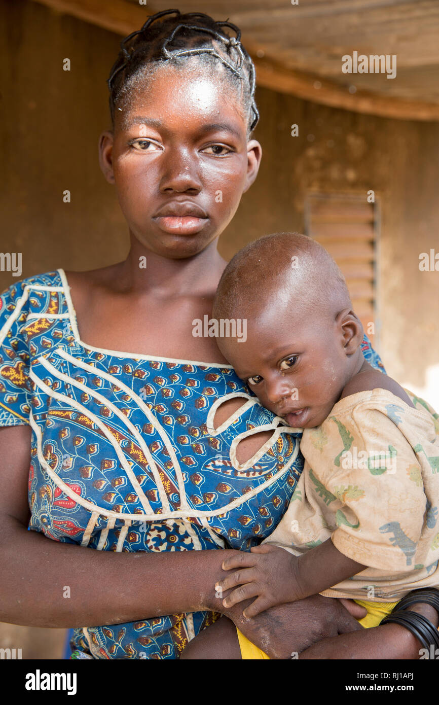 Il villaggio di Samba, Provincia Yako, Burkina Faso: Abzetta Sondo, 19, ed il suo bambino Noel Nougtara, 15 mesi. Il bambino soffre di malnutrizione acuta Foto Stock