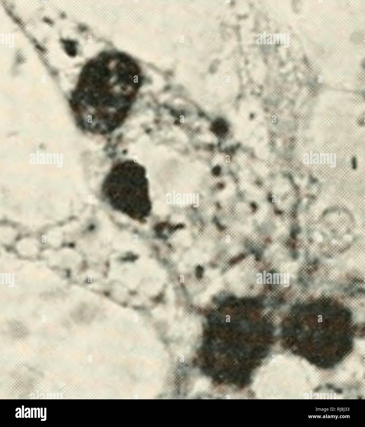 . La chimica e la fisiologia della crescita. La crescita; biochimica. I'LAii: 1. Le trasformazioni di Schwann racconta da nervi periferici di ratti adulti in coltura tissutale (niod- ilietl da Weiss e Wang, 1945). Tutte le figure a iden- tical ingrandimento (X 710). Il pannello 1 mostra l'originale sottile forma di mandrino di cellule di Schwann appena ime- reticolo dal nervo. L'immagine contiene anche due grandi endoneurial fibroblasti (grande, ovale, leggermente colorate nuclei; scuro, sutian macchiate di goccioline di grasso nel citoplasma). Il pannello 2 mostra inizio propaggine delle cellule di Schwann nel coagulo di plasma (nota a forma di asta e nuclei f Foto Stock