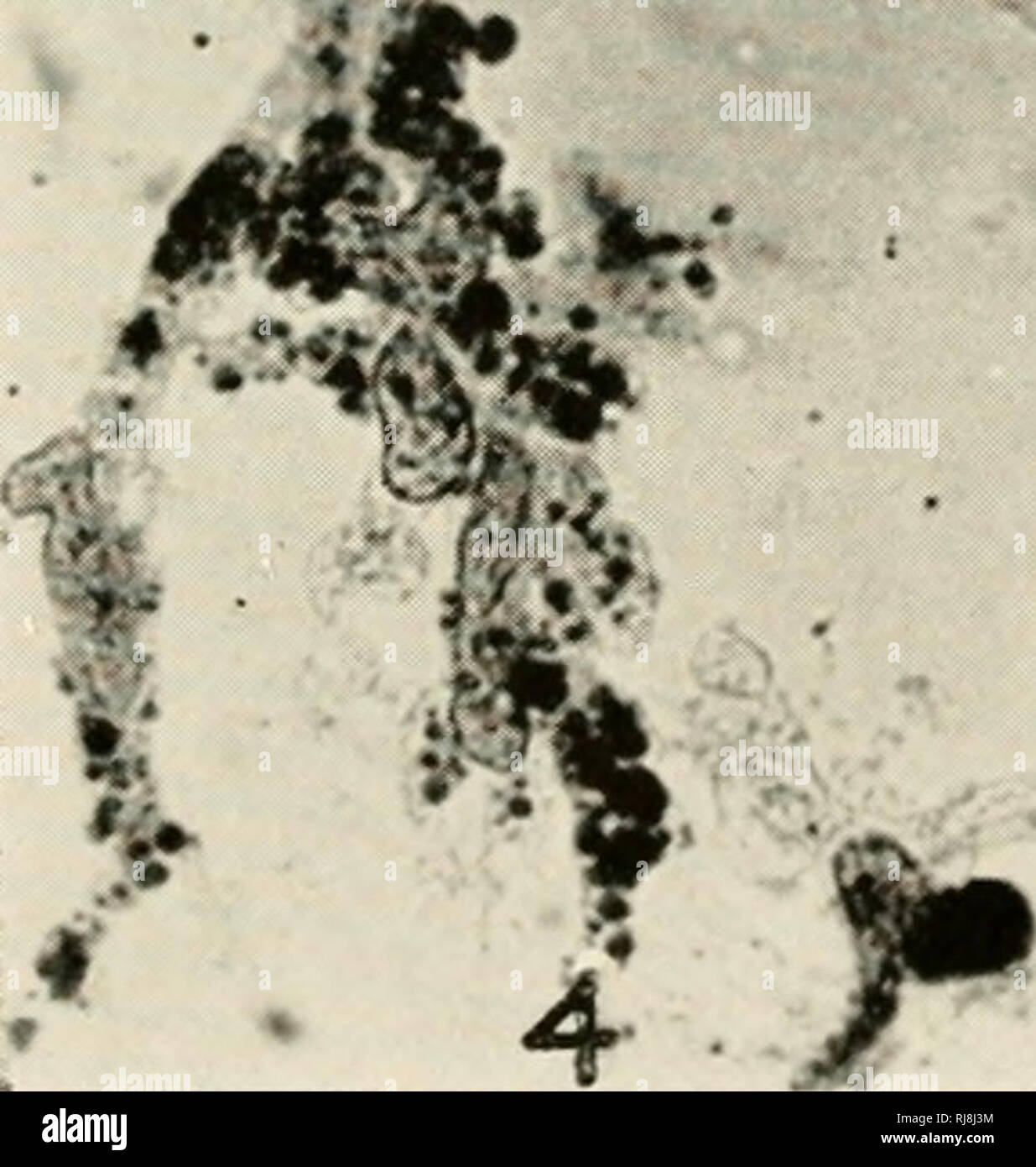 . La chimica e la fisiologia della crescita. La crescita; biochimica. Â *S'4^. Â¢â ¢ Z/^^*" w %â ^. I'LAii: 1. Le trasformazioni di Schwann racconta da nervi periferici di ratti adulti in coltura tissutale (niod- ilietl da Weiss e Wang, 1945). Tutte le figure a iden- tical ingrandimento (X 710). Il pannello 1 mostra l'originale sottile forma di mandrino di cellule di Schwann appena ime- reticolo dal nervo. L'immagine contiene anche due grandi endoneurial fibroblasti (grande, ovale, leggermente colorate nuclei; scuro, sutian macchiate di goccioline di grasso nel citoplasma). Il pannello 2 mostra inizio propaggine delle cellule di Schwann nel plasma Foto Stock