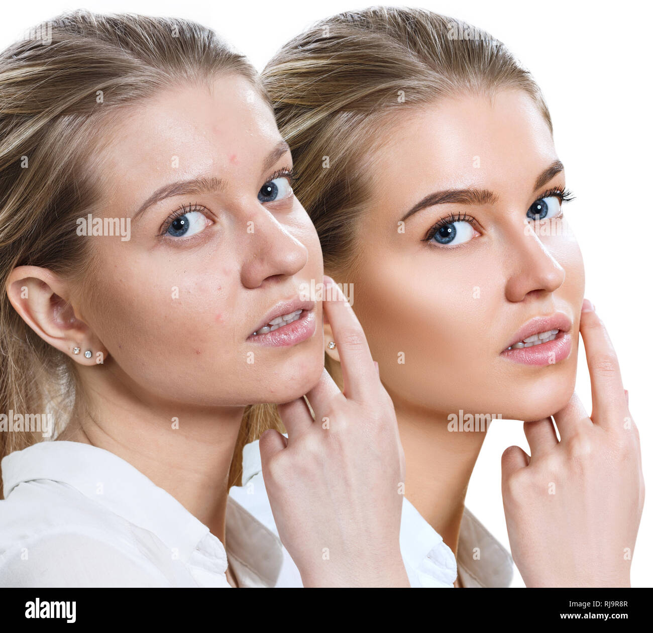 Giovane donna prima e dopo il trattamento della pelle e del trucco. Foto Stock