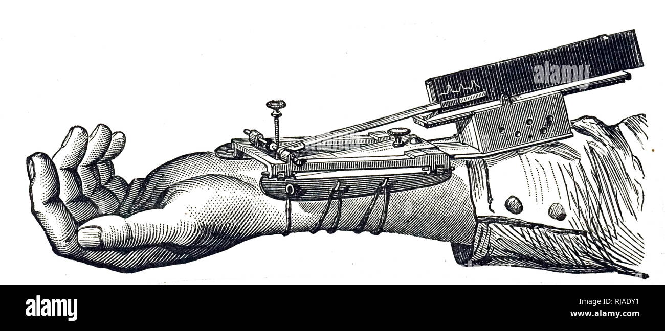 Una incisione raffigurante un sphygmograph, un dispositivo inventato da Marey Étienne-Jules per la registrazione il polso e variazioni graficamente nel sangue e la pressione. Étienne-Jules Marey (1830-1904) uno scienziato francese, fisiologo chronophotographer e. Datata del XIX secolo Foto Stock